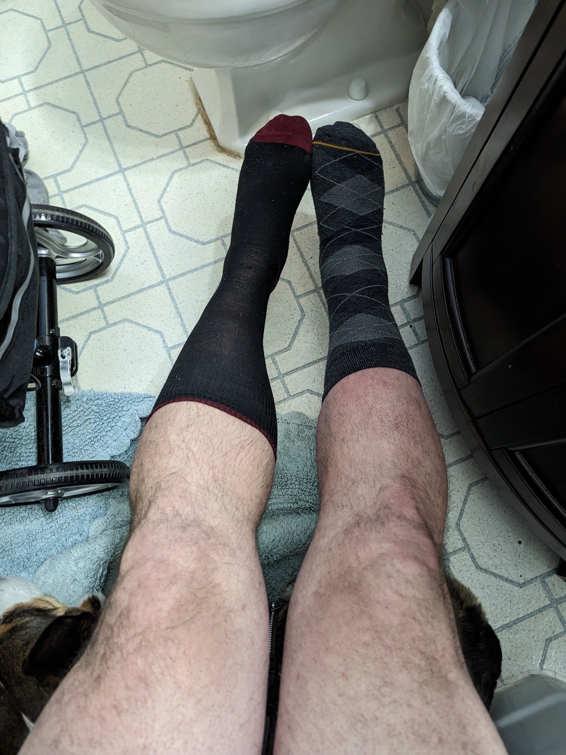 A photo showing the difference in appearance between my injured leg / calf and my uninjured leg/calf